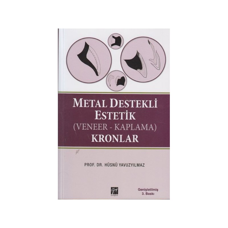 Metal Destekli Estetik Veneer Kaplama Kronlar